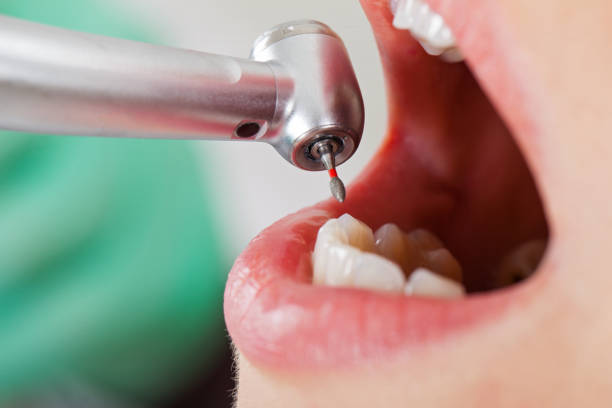 Tooth Infection Emergency Dentist in IL